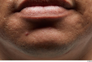 HD Face Skin Dante Pozoz chin face lips mouth scar…